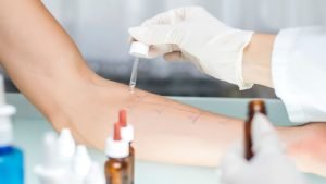 Allergy testing