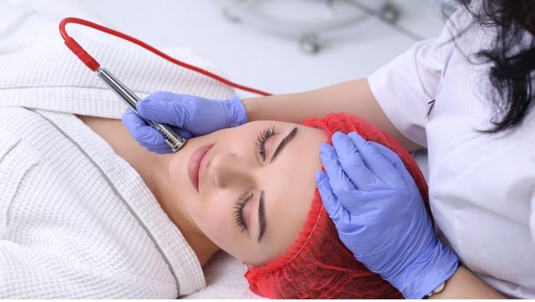Microdermabrasion For Acne