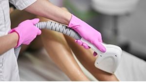 laser hair removal