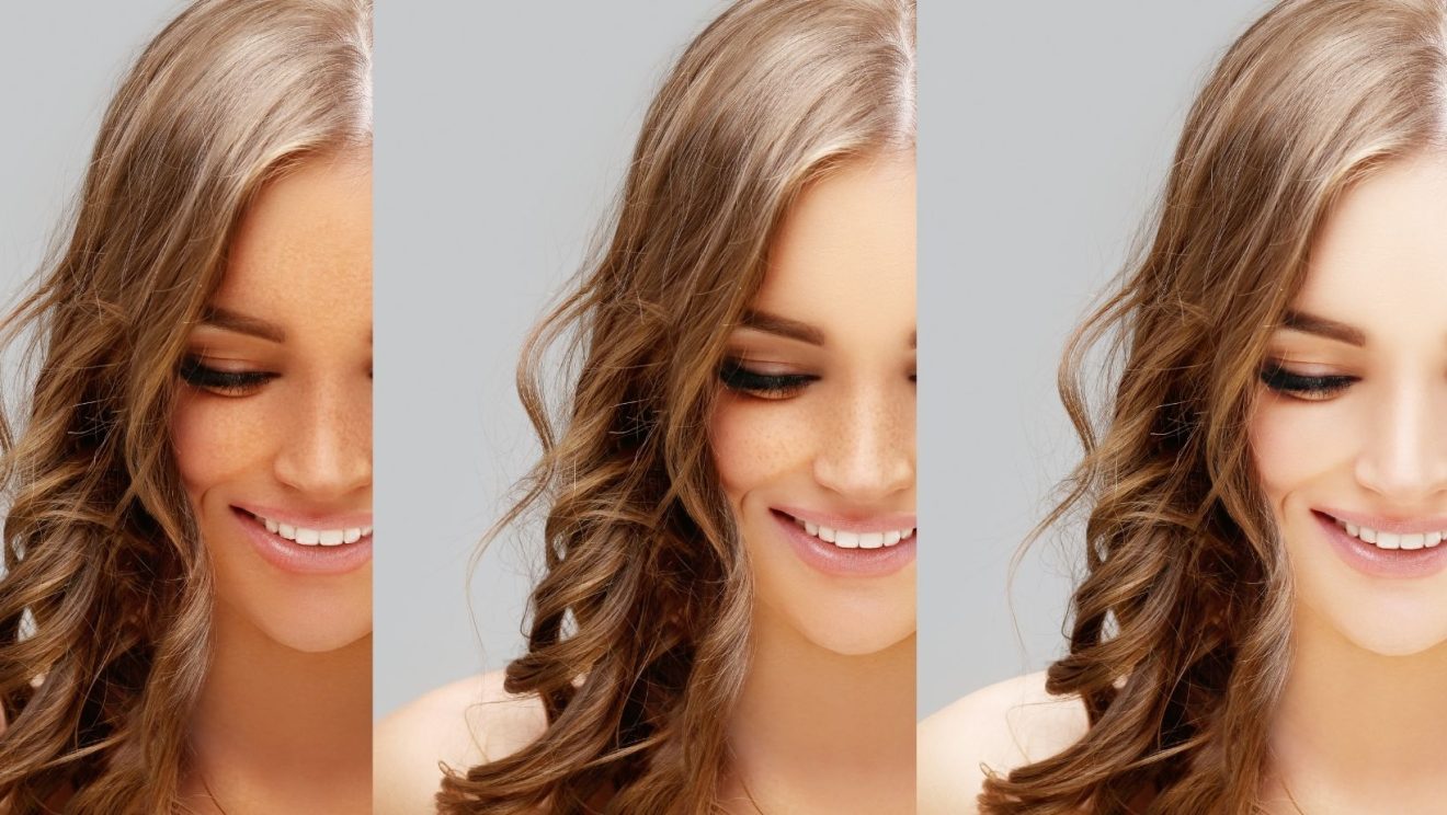 How to Lighten Your Skin Tone Sparsh Skin Clinic