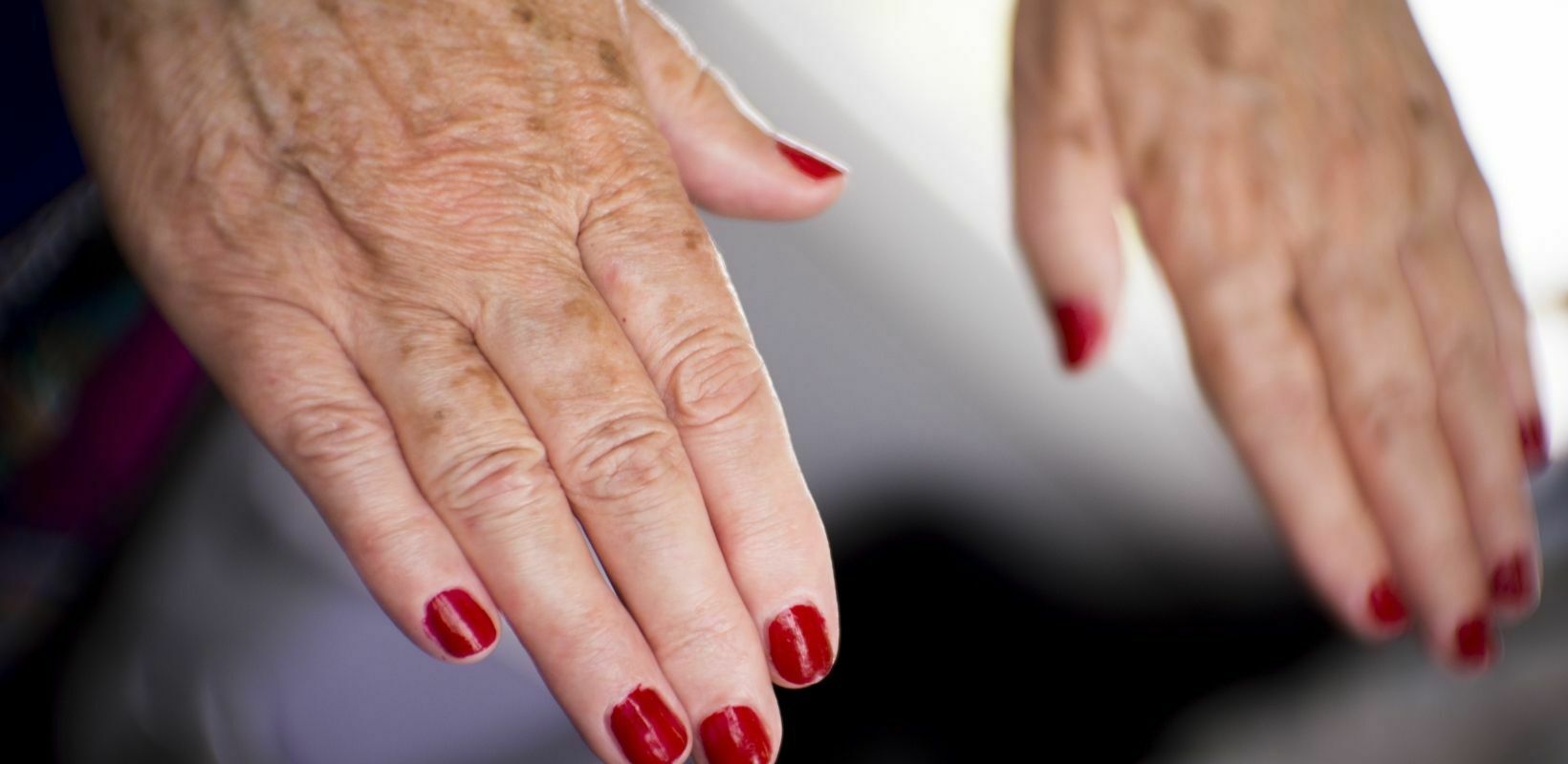 Auto-Immune Skin Problems and Lupus