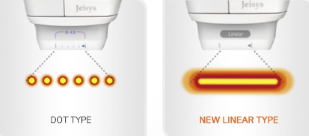 Understanding Linear HIFU vs. Dot HIFU: Key Differences and the Importance of Genuine Brands - Sparsh Skin Clinic